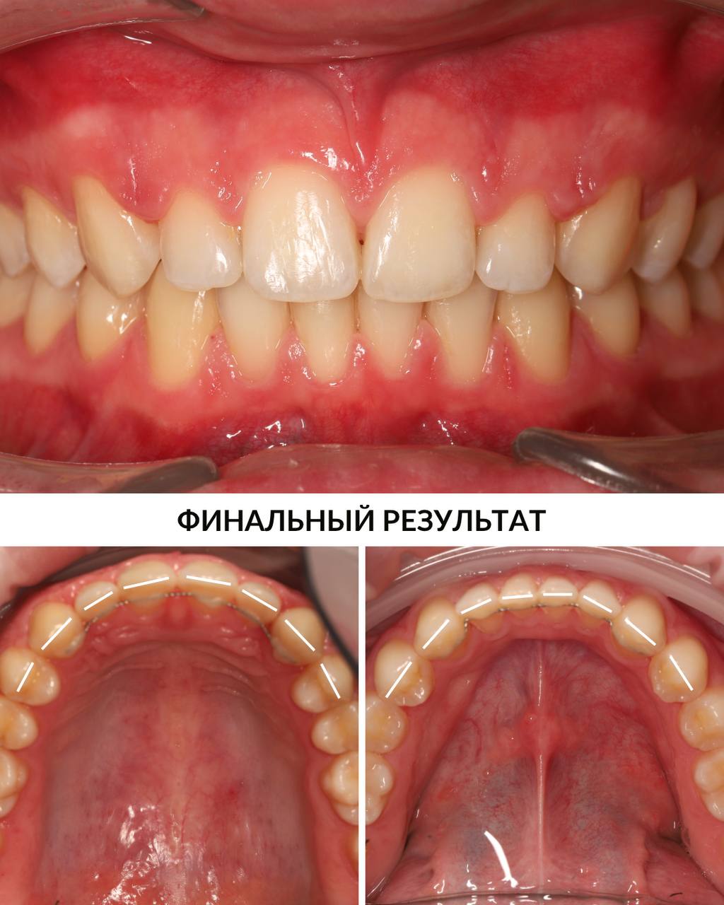 До / Финальный результат — После
