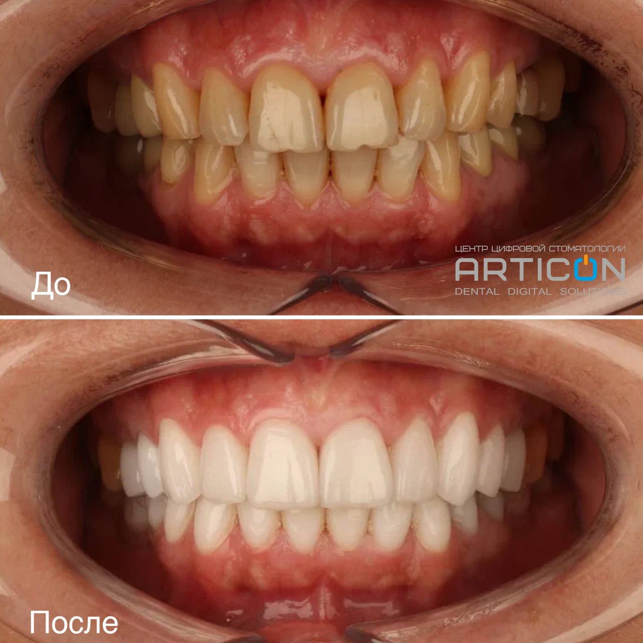 Articon - Цифровая семейная стоматология в Москве