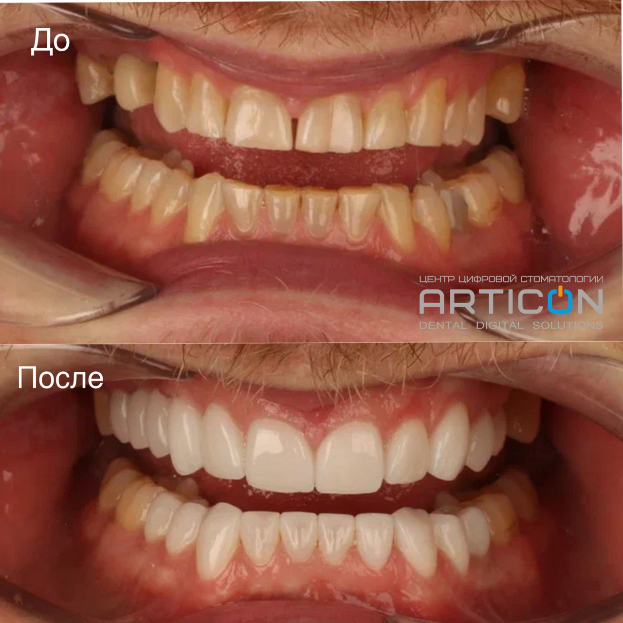 Articon - Цифровая семейная стоматология в Москве