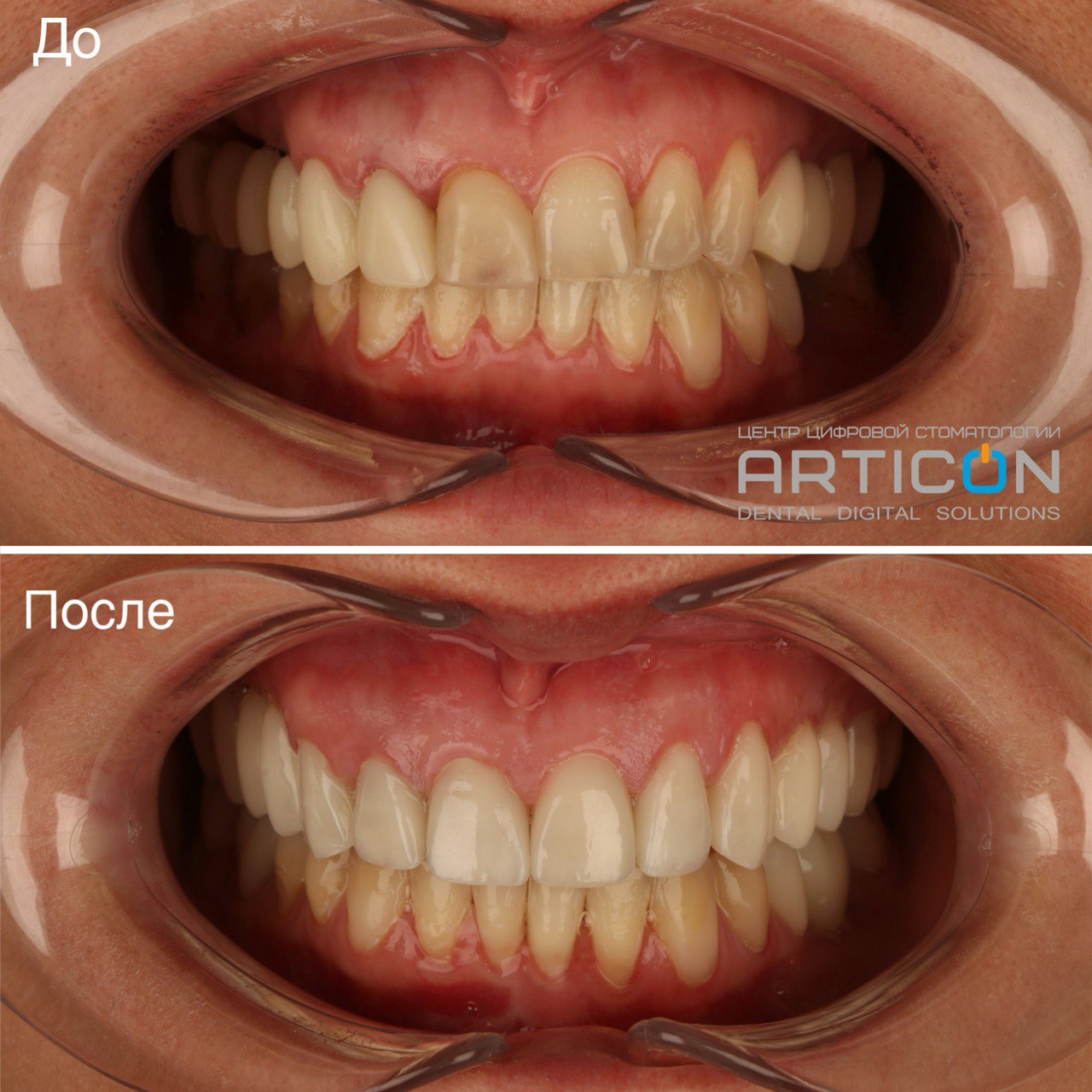 Articon - Цифровая семейная стоматология в Москве